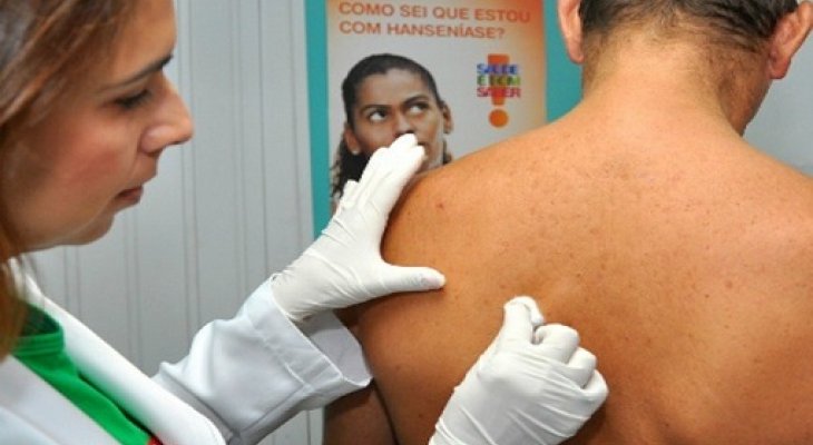 Imagem notícia
